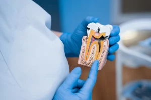 endodoncia