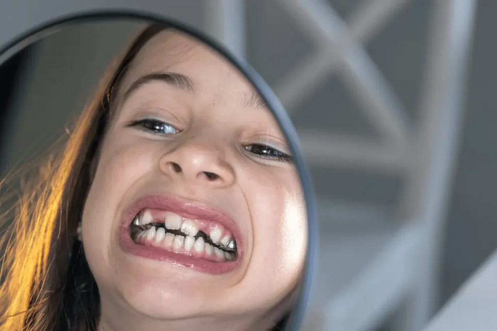 niña enseñando los dientes