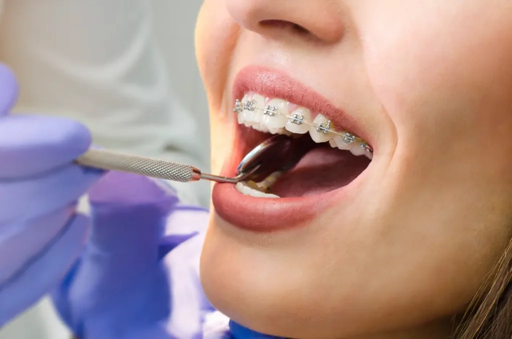 controles periódicos brackets